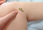 小腿水腫是什么原因引起的？教你輕松解決之道