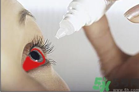 紅眼病的表現(xiàn)狀態(tài)有哪些?紅眼病怎么治療? 紅眼病的表現(xiàn)狀態(tài)有哪些?紅眼病怎么治療?