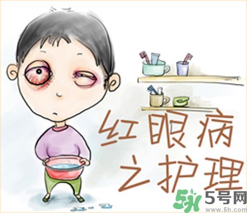 紅眼病的表現(xiàn)狀態(tài)有哪些?紅眼病怎么治療? 紅眼病的表現(xiàn)狀態(tài)有哪些?紅眼病怎么治療?