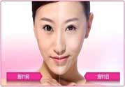 美白針真的有效嗎？美白針的危害有哪些？