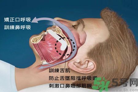 耳鳴是什么原因引起的？耳鳴怎么治療最好？