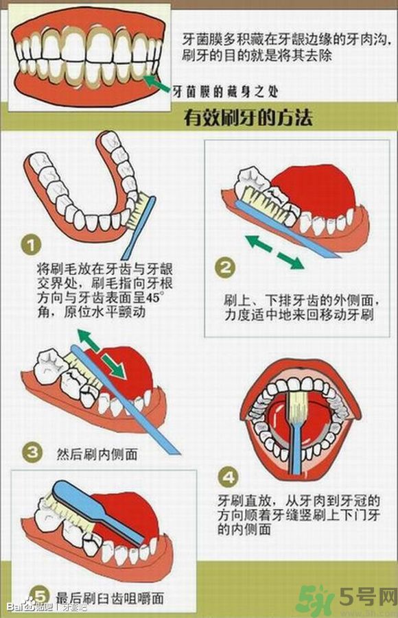 18歲還能戴牙套嗎？戴牙套真的能瘦臉改變臉型嗎？