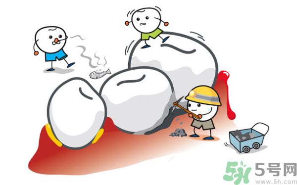 牙齦出血是怎么回事？牙齦出血怎么辦？