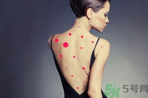 背上為什么會(huì)長痘痘？長痘痘怎么辦？