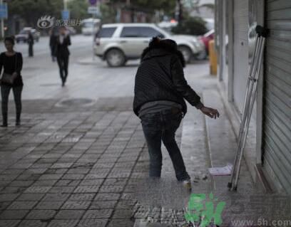 學(xué)生患東方美女病是怎么回事？東方美女病是什么?。? width=