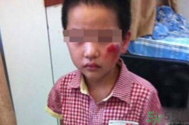 男孩遭校長暴打的結果是什么？男孩遭校長暴打的真相是什么？