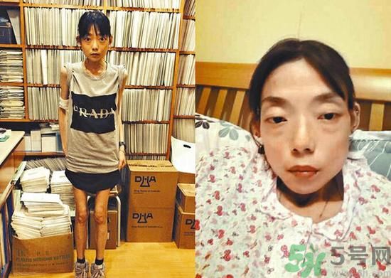 富二代離婚娶二線女星前妻瘦成骷髏  怎么選擇有責(zé)任的男人？