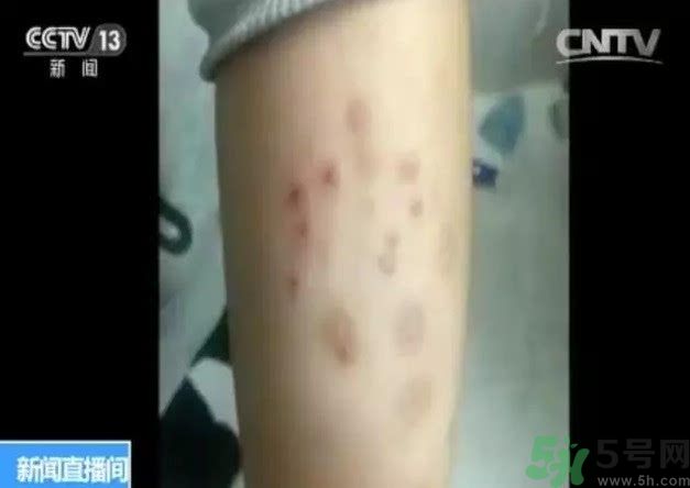 被污染學(xué)校是哪個(gè)？500師生患病的原因？