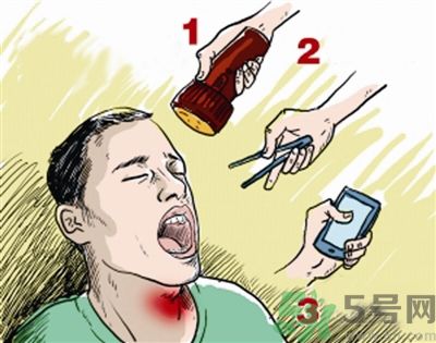 魚刺卡喉喝醋可以治療嗎？魚刺卡喉喝醋好不好？