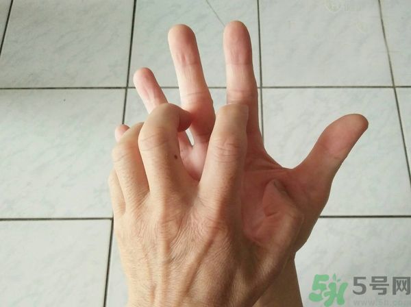 手上起水泡是什么原因？怎樣預(yù)防手上起水泡？