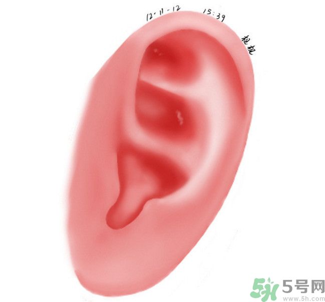耳石脫落導(dǎo)致的眩暈怎么辦？耳石癥暈眩能自愈嗎？