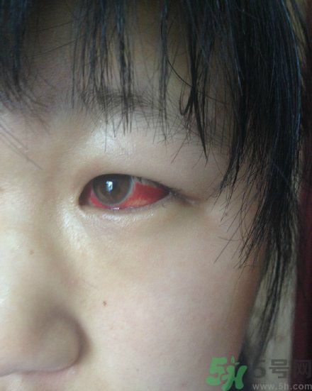 初中生全體甲醛中毒是怎么回事？初中生全體甲醛中毒是哪個學(xué)校？