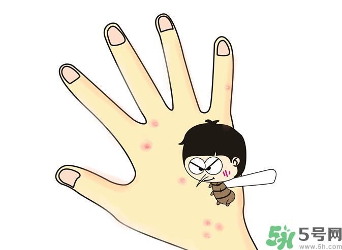 蚊子叮的包過幾天又癢是為什么？蚊子叮的包過幾天又癢怎么辦？