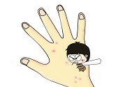 蚊子叮的包過(guò)幾天又癢是為什么？蚊子叮的包過(guò)幾天又癢怎么辦？