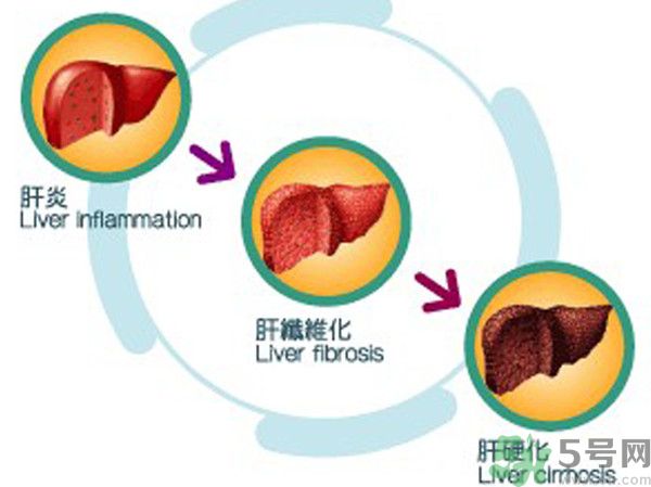 在外面吃飯會得乙肝嗎？在食堂吃飯會得乙肝嗎？