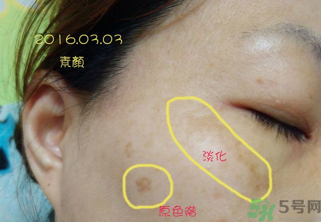 sk2祛斑精華怎么樣？skii祛斑精華使用方法