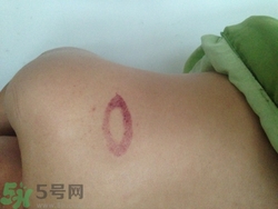 種草莓吻痕是什么意思？吻痕是怎么弄出來的？