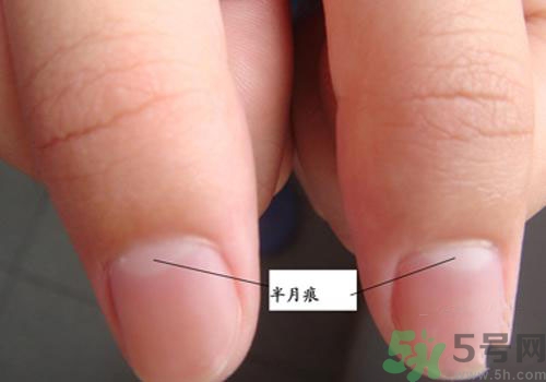 指甲沒有月牙是什么原因？指甲沒有月牙怎么調(diào)理？