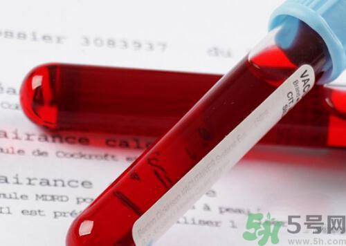 獻(xiàn)血后可以洗澡嗎？抽血后可以洗澡嗎？