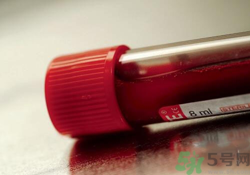 獻(xiàn)血后可以洗澡嗎？抽血后可以洗澡嗎？