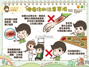 手被油燙傷了怎么處理？手被油燙起泡了怎么辦？