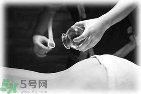 大暑可以拔罐嗎？大暑拔罐好不好？