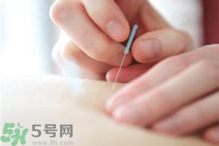 大暑可以針灸嗎？大暑針灸好不好？