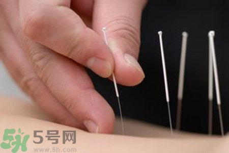 大暑可以針灸嗎？大暑針灸好不好？