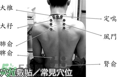 經(jīng)期可以貼三伏貼嗎？來月經(jīng)可以貼三伏貼嗎？