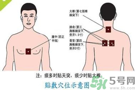 肝炎貼三伏貼有用嗎？肝病貼三伏貼貼哪里？