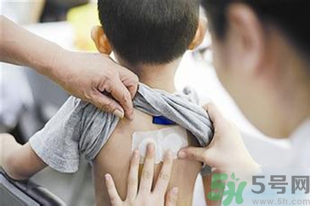 三伏貼能治頸椎病嗎？頸椎病三伏貼穴位