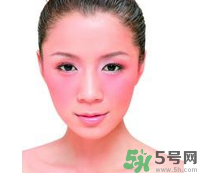 敏感性皮膚用什么洗面奶？敏感性皮膚怎么修復(fù)？