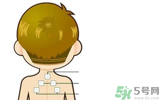 貼三伏貼可以吹空調(diào)嗎？貼完三伏貼多久后可以吹空調(diào)？