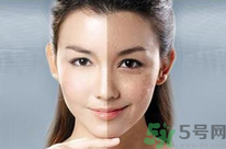 干性皮膚用什么洗面奶？干性皮膚該怎么保養(yǎng)？