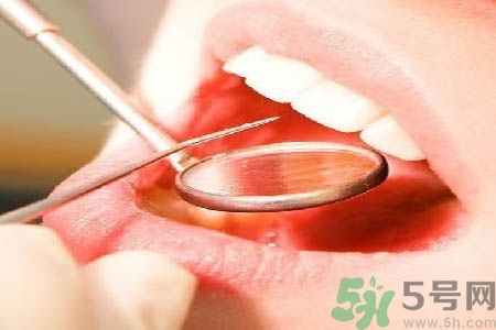 冷光美白牙齒是什么？冷光美白牙齒的好處有哪些？