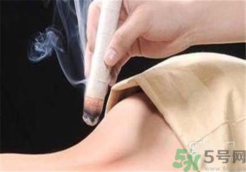 蕁麻疹可以艾灸嗎？蕁麻疹艾灸哪個穴位？