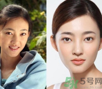 開眼角眼睛會變大嗎？開眼角眼睛能大多少？