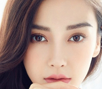 開眼角會留疤嗎？開眼角增生怎么辦？