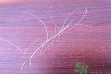 生完寶寶白頭發(fā)的原因？生完寶寶白頭發(fā)怎么辦？