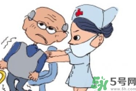 癲癇的典型癥狀有哪些？癲癇是什么？
