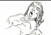 癲癇的發(fā)病因素？癲癇的并發(fā)癥有哪些？