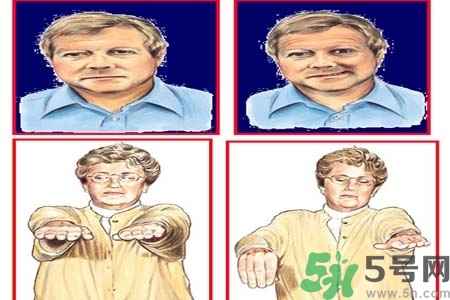 腦中風(fēng)是什么？腦中風(fēng)的癥狀？