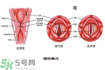 慢性咽炎是什么？慢性咽炎的癥狀有哪些？