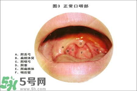 慢性咽炎的治療方法？慢性咽炎的藥物治療？