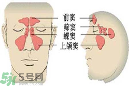 鼻竇炎的治療方法？鼻竇炎的藥物治療？