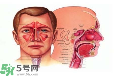 鼻竇炎的高發(fā)人群？如何預(yù)防鼻竇炎？