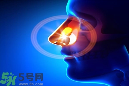 鼻竇炎的高發(fā)人群？如何預(yù)防鼻竇炎？