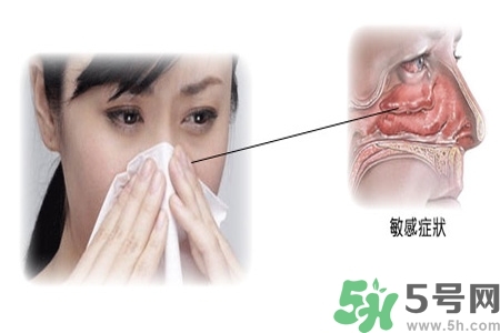 過(guò)敏性鼻炎的高發(fā)人群有哪些？如何預(yù)防過(guò)敏性鼻炎？