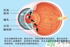 青光眼是什么？青光眼癥狀有什么？