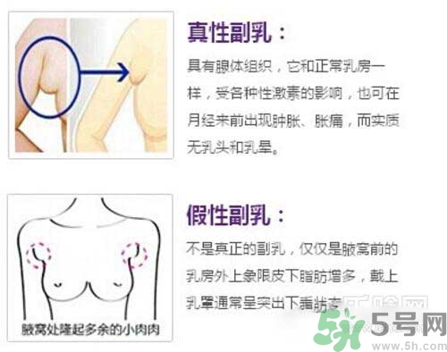 副乳是什么？副乳的危害